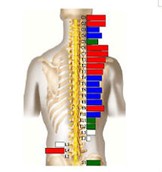 Thermal Scan at Fitterer Chiropractic